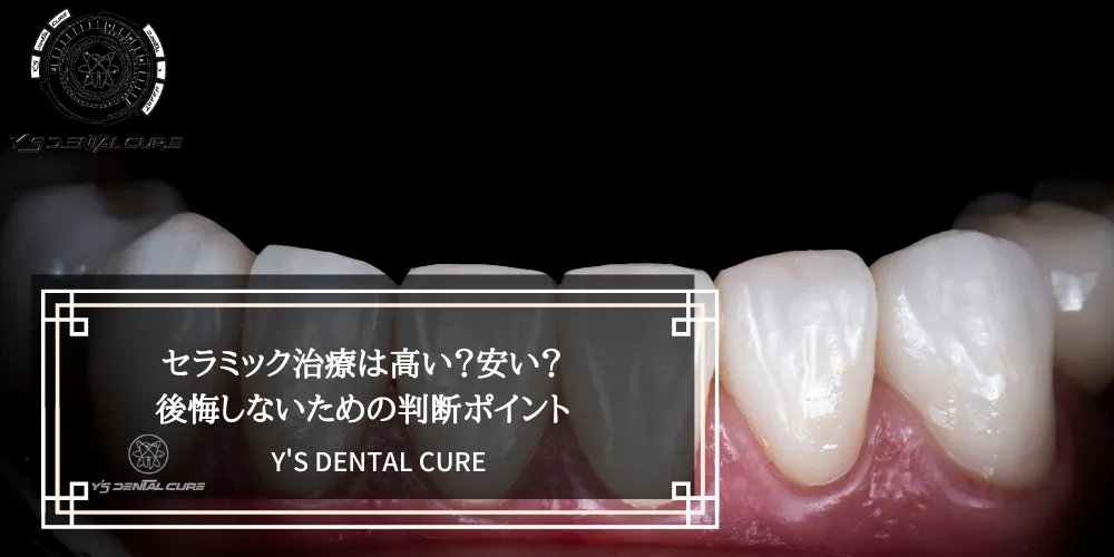 セラミック治療は高い？安い？後悔しないための判断ポイント