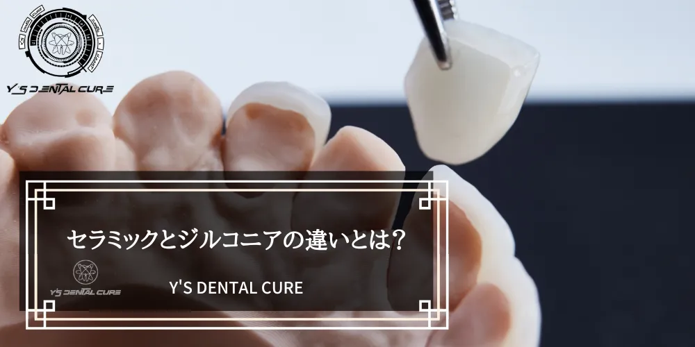 セラミックとジルコニアの違いとは？