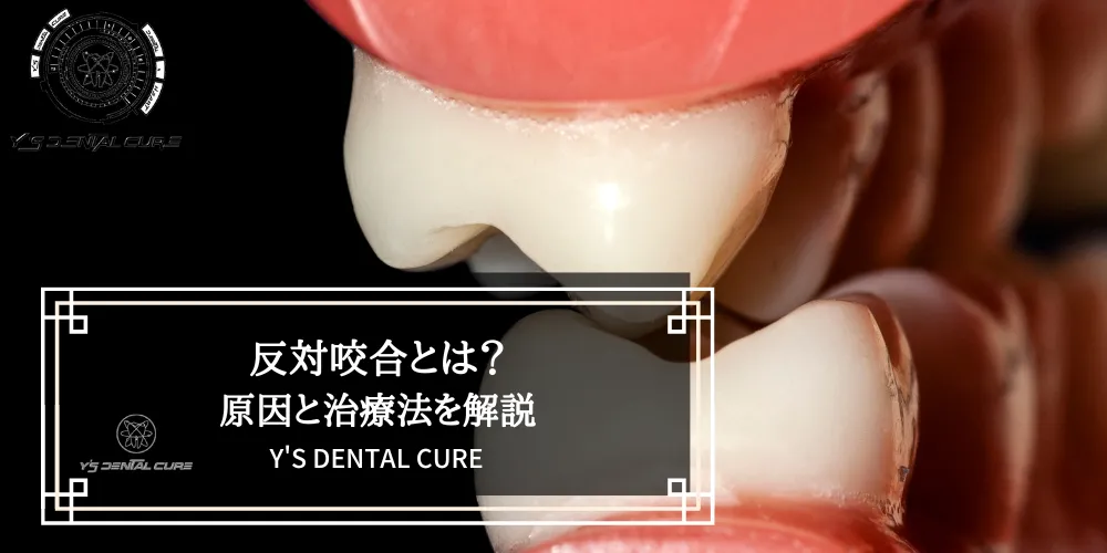 反対咬合とは？原因と治療法を解説