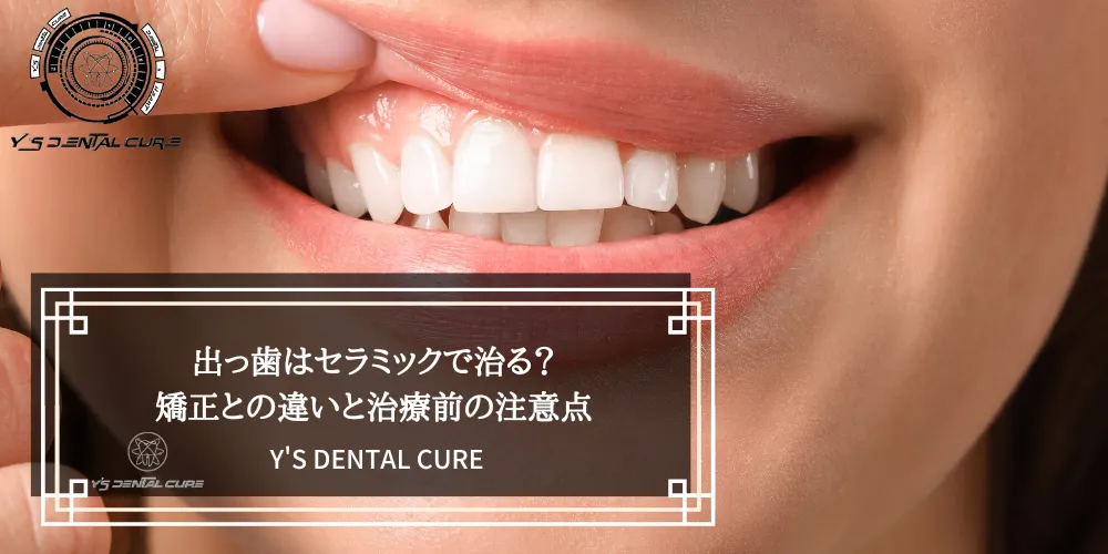 出っ歯はセラミックで治る？矯正との違いと治療前の注意点