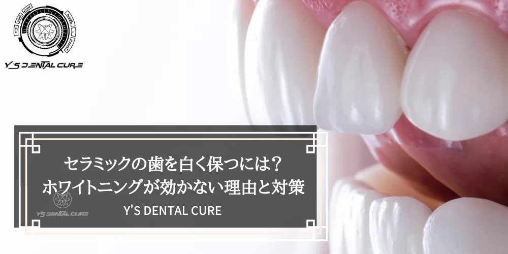 セラミックの歯を白く保つには？ホワイトニングが効かない理由と対策