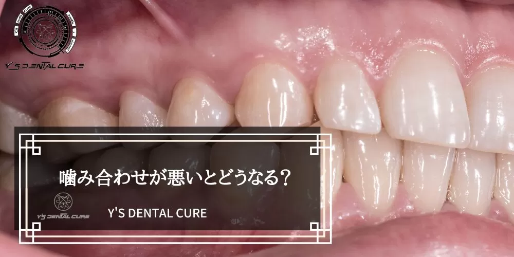 噛み合わせが悪いとどうなる?
