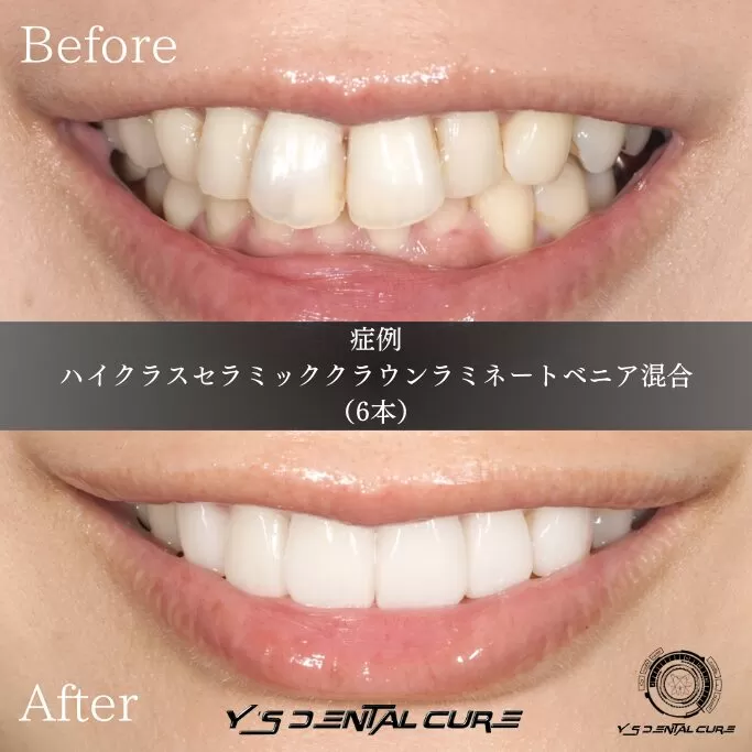 疑似的に平面を作り出す