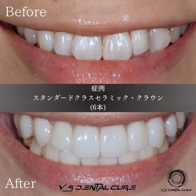 スタンダードでも自然な質感を実現